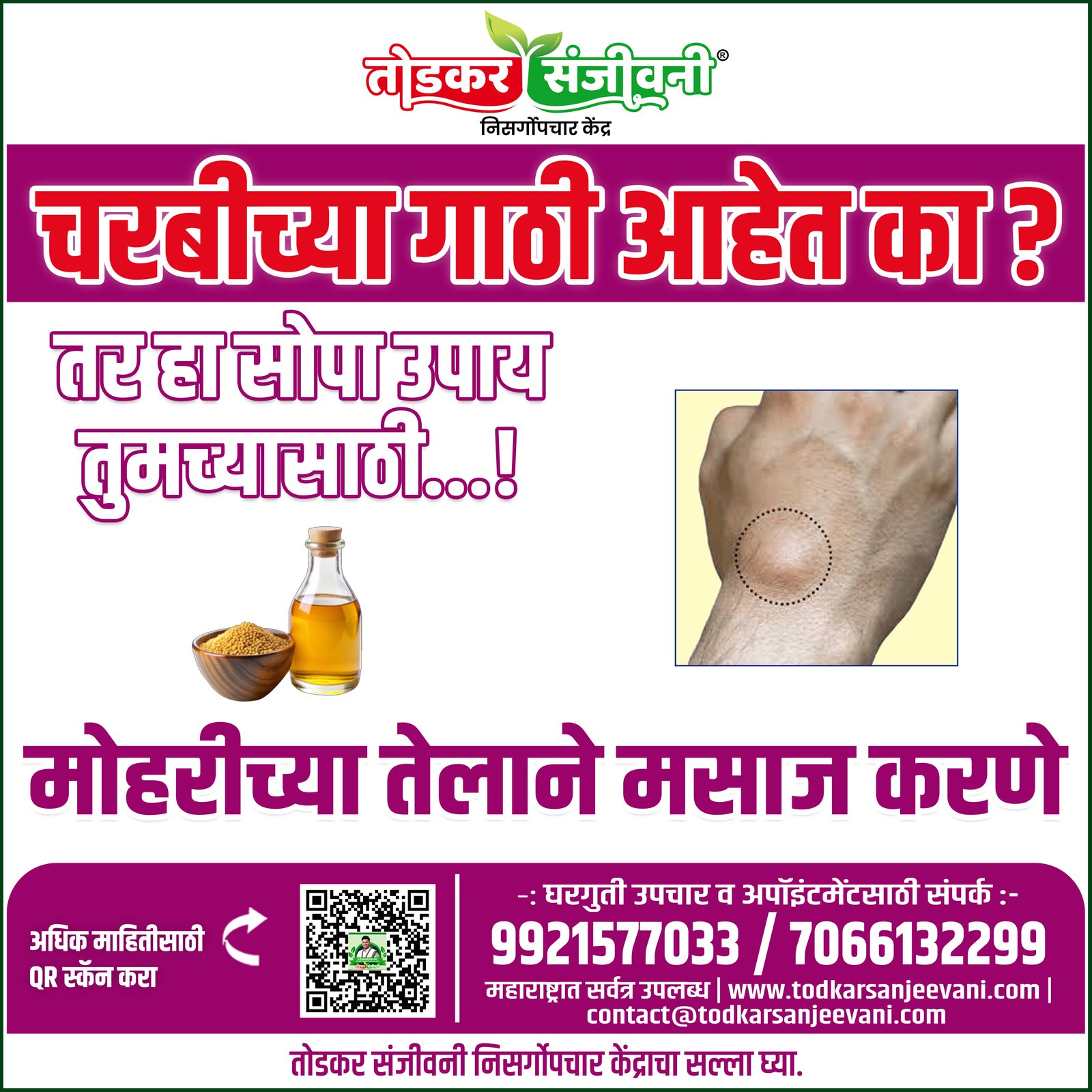 Charbi Gath (Lipoma)